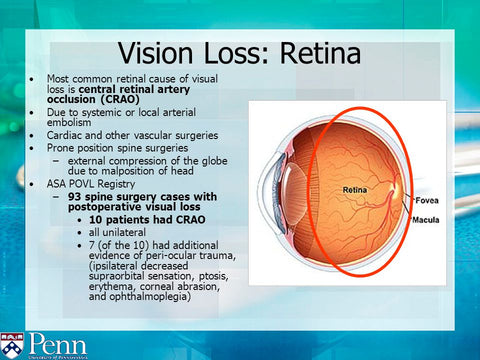 Causes of vision loss